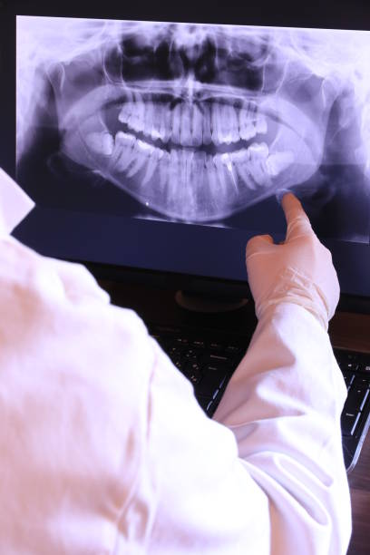 Best Emergency Root Canal Treatment in Mapleton, IA