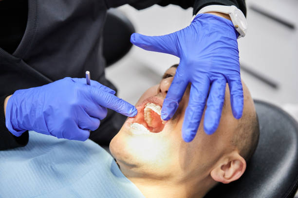 Best Emergency Dentist for Lost Fillings or Crowns in Mapleton, IA