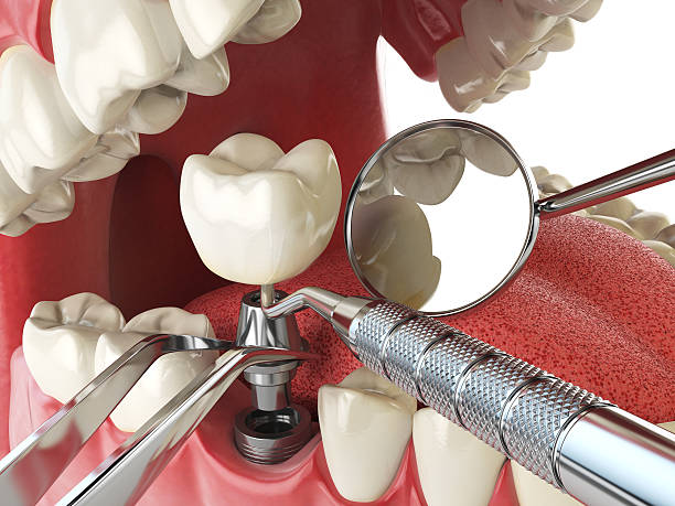 Best Emergency Dental Services for Seniors in Mapleton, IA
